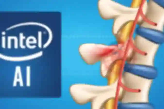 Intel and Brown University Deploy AI to Help Paralyzed Patients