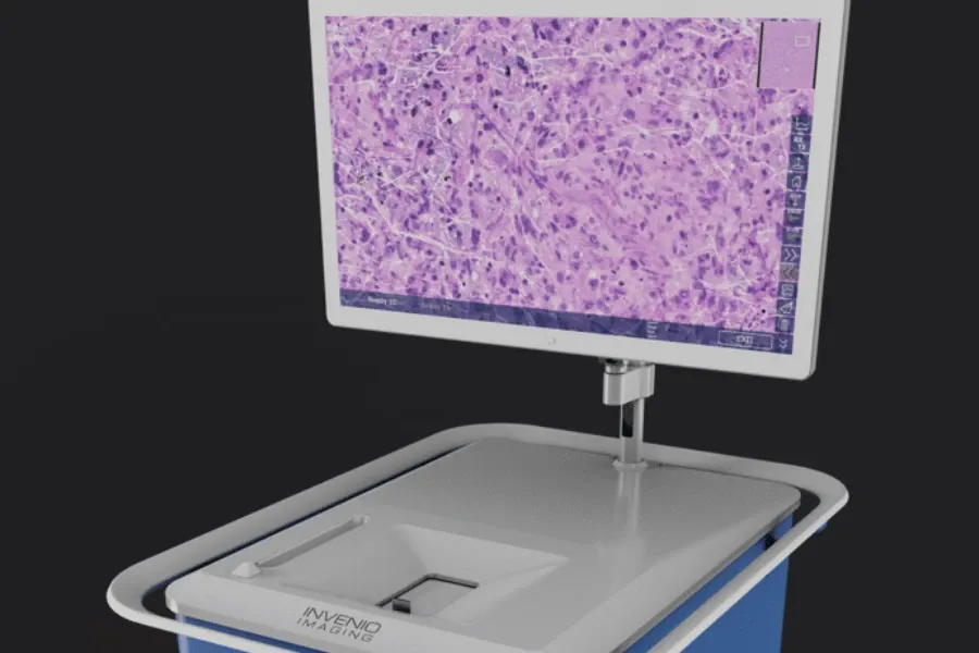 AI Will Analyze Cancer Cells in the Operating Room