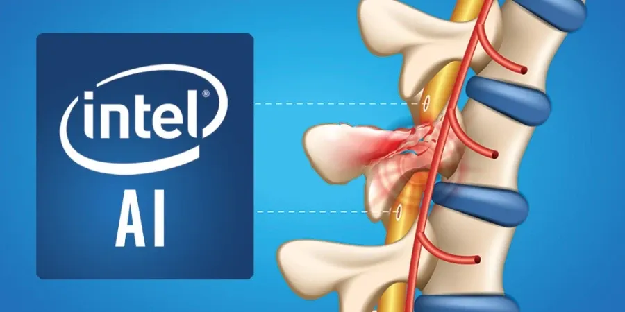 Intel and Brown University Deploy AI to Help Paralyzed Patients